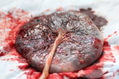 Placenta Picture